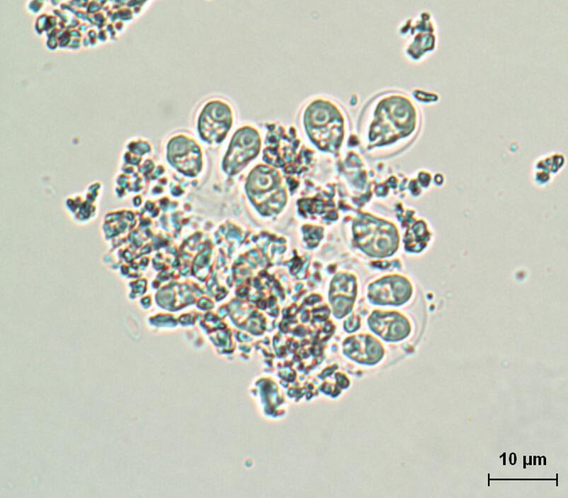 Представитель Семейства Chlorangiellaceae
